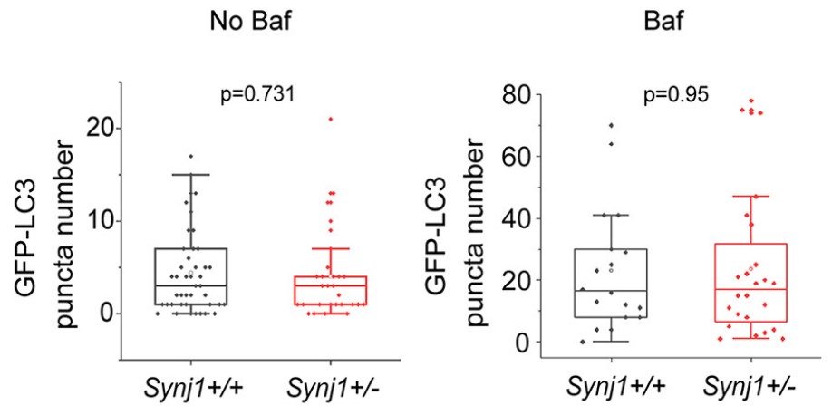 GFP-LC3-labeled autophagosome.jpg